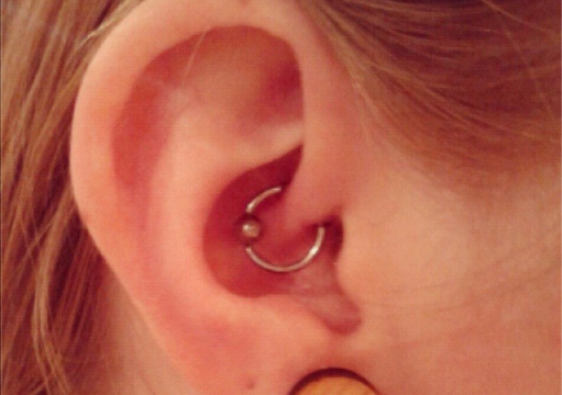 I Got a Daith Piercing for Migraines