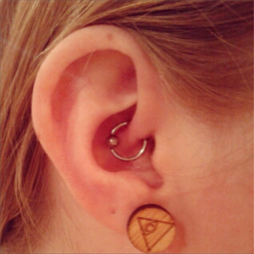 daith piercing through the ear's innermost cartilage fold, the crus of the helix